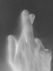 В Амстердаме закидали обувью